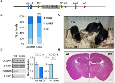 Loss of the Intellectual Disability and Autism Gene Cc2d1a and Its Homolog Cc2d1b Differentially Affect Spatial Memory, Anxiety, and Hyperactivity